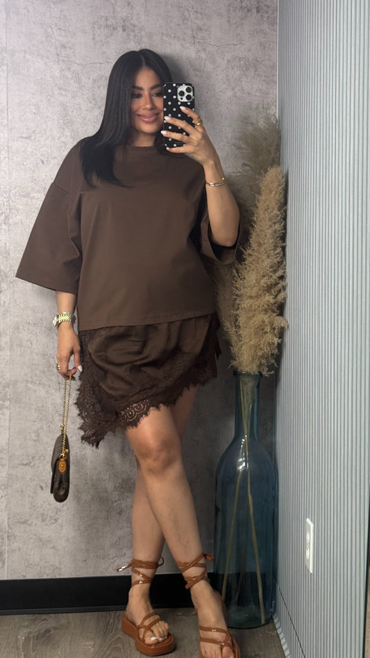OVER SIZED SHIRT DRESS W LACE BUTTER BROWN