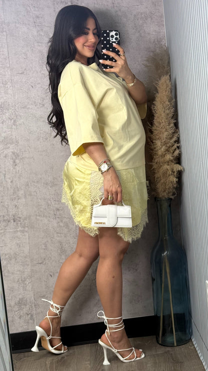 OVER SIZED SHIRT DRESS W LACE BUTTER YELLOW