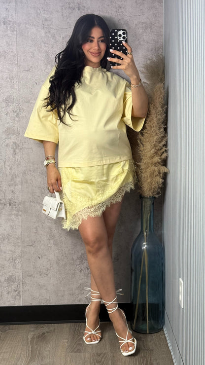 OVER SIZED SHIRT DRESS W LACE BUTTER YELLOW